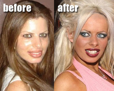 Jessica Simpson Plastic Surgery