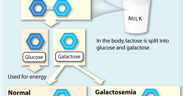 Most Common Enzyme Deficiency Responsible For Galactosemia Is: