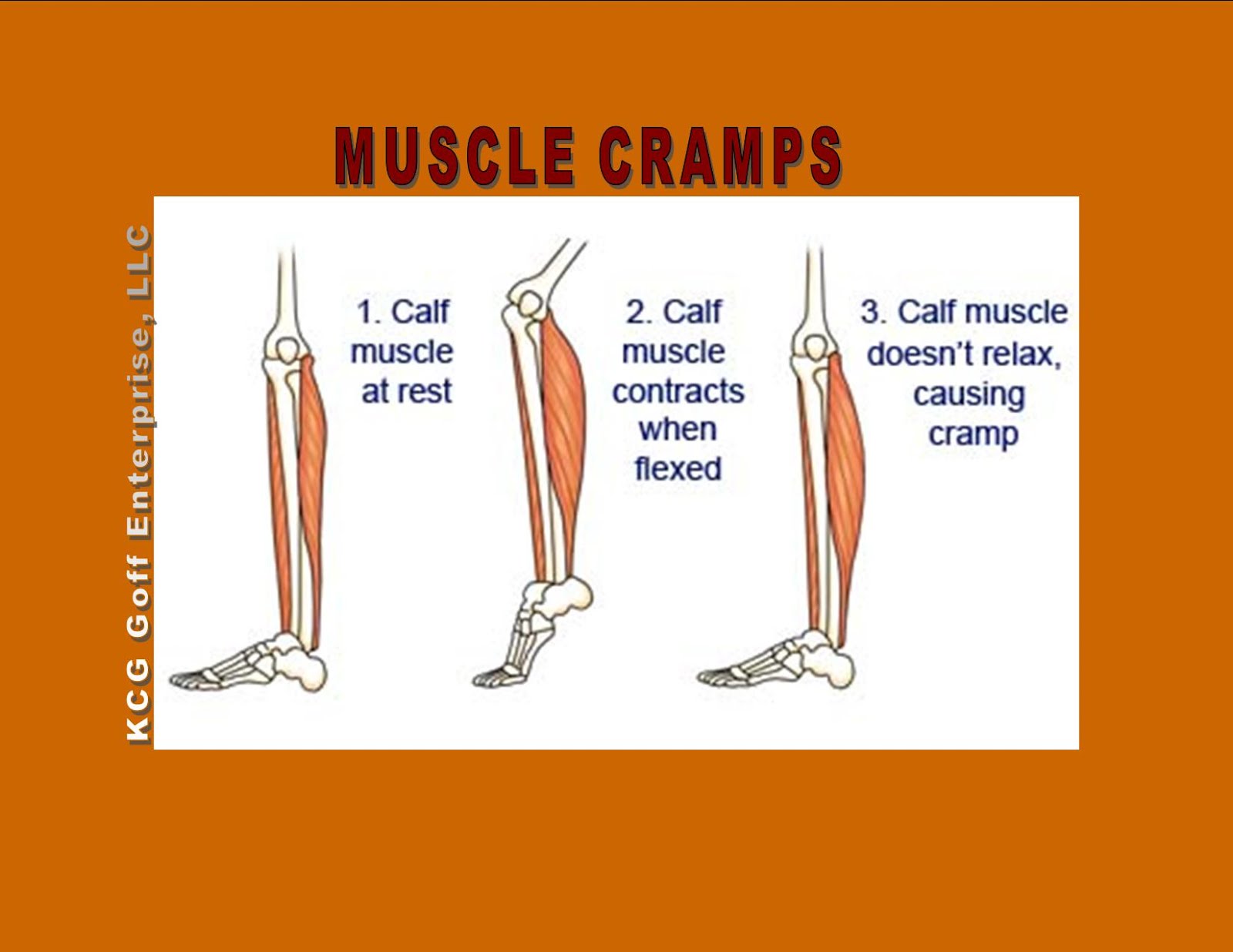Calf Muscle Pain