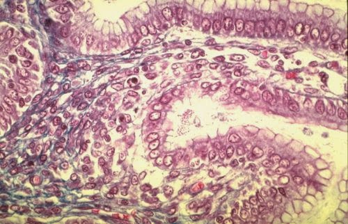 Tissus conjonctif conjonctifs différents fibres organisme lâche proprement cellules derme Tissus conjonctifs Cours | Bio faculté