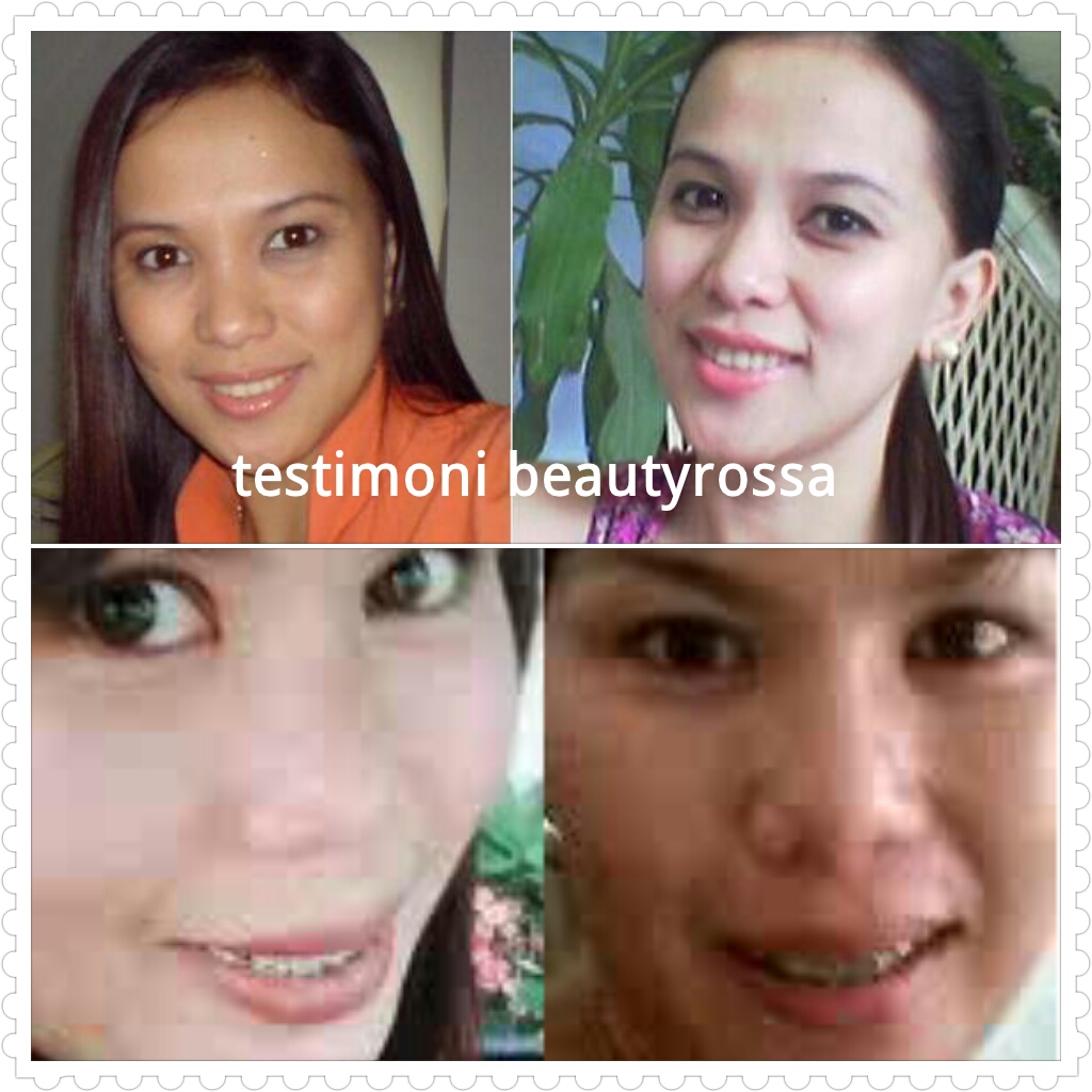 rossa testimoni pengguna cara pemakaian produk beauty rossa terbaru