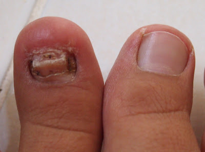 puteri manja: Kuku jariku dah tak cantik!