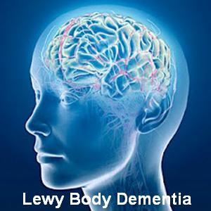 ok google lewy body dementia