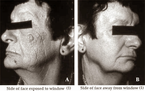 effect of sun on collagen and elastin