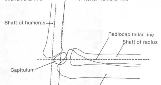 radiographic anatomy of the elbow joint