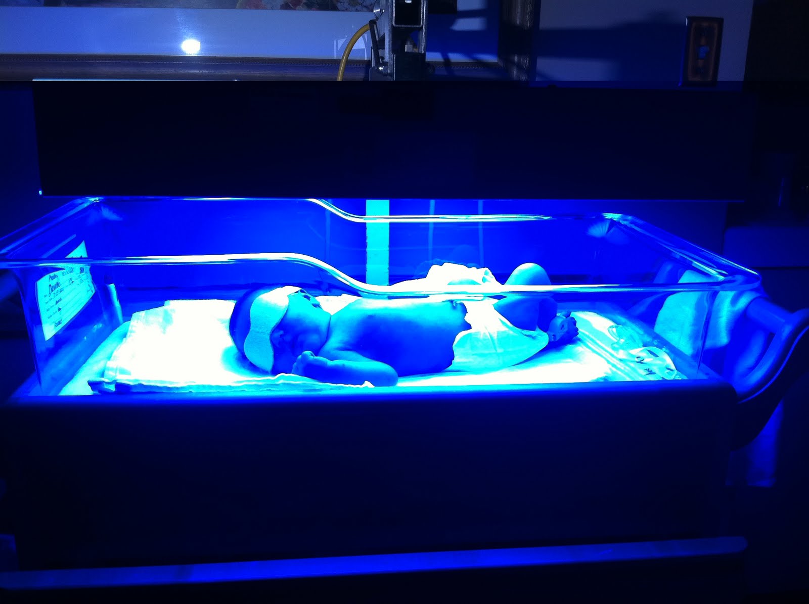 Baby Mama Drama Dang Ol' Bilirubin