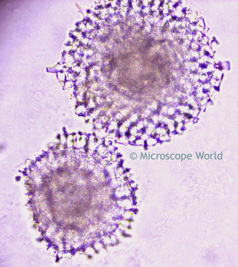 Radiolaria under microscope 400x