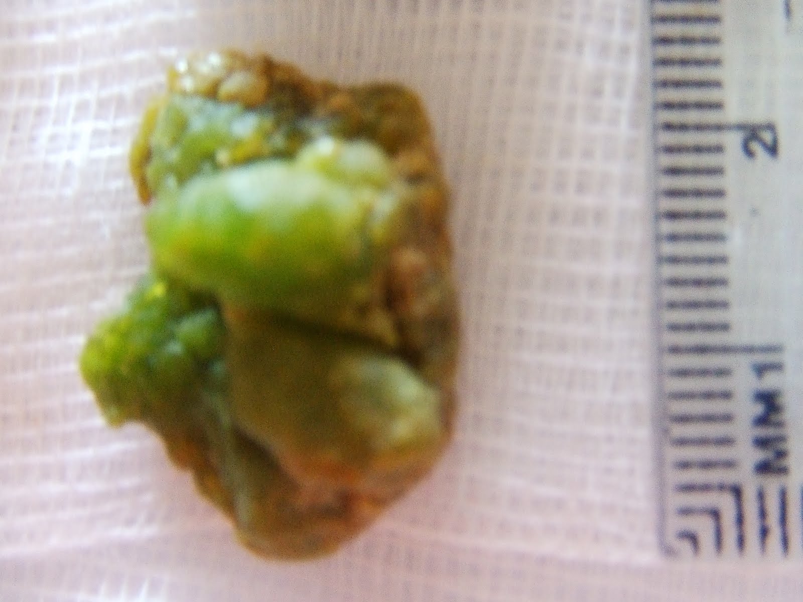 Pietre La Fiere Cum Le Depistăm Doza De Sănătate