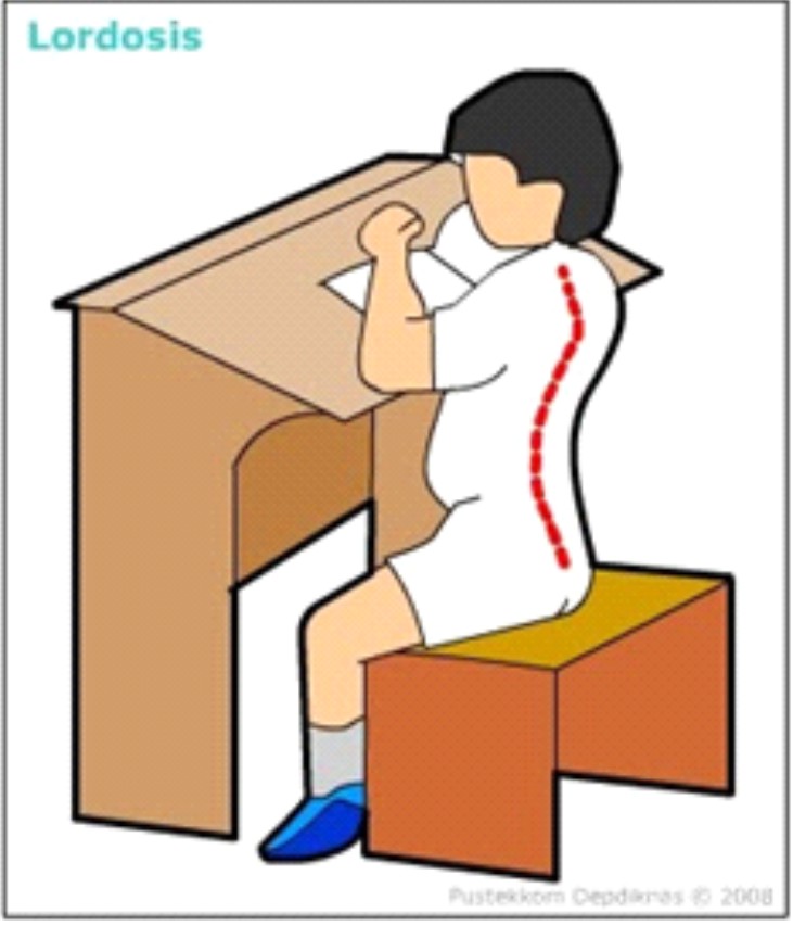 Shofia�s Blog Kelainan atau Penyakit pada Tulang