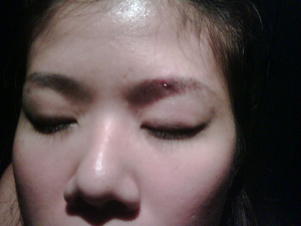 Bummerina Wham, Bang! Bleeding Eyebrows!