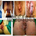 Antihemoroid Ambeclear Terbaru thumbnail