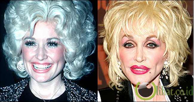 Dolly Parton Dolly Parton
