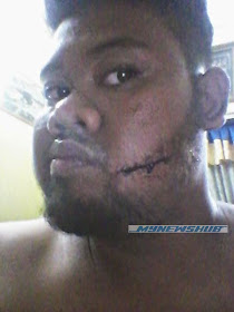 Lelaki Diserang 13 Samseng Jalanraya, info, terkini, berita, samseng jalanraya, 