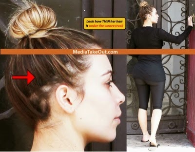 Kim Kardashian Suffering From Hair Loss Photo 9jasouth Com