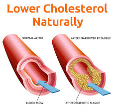 How to Lower High Cholesterol Naturally