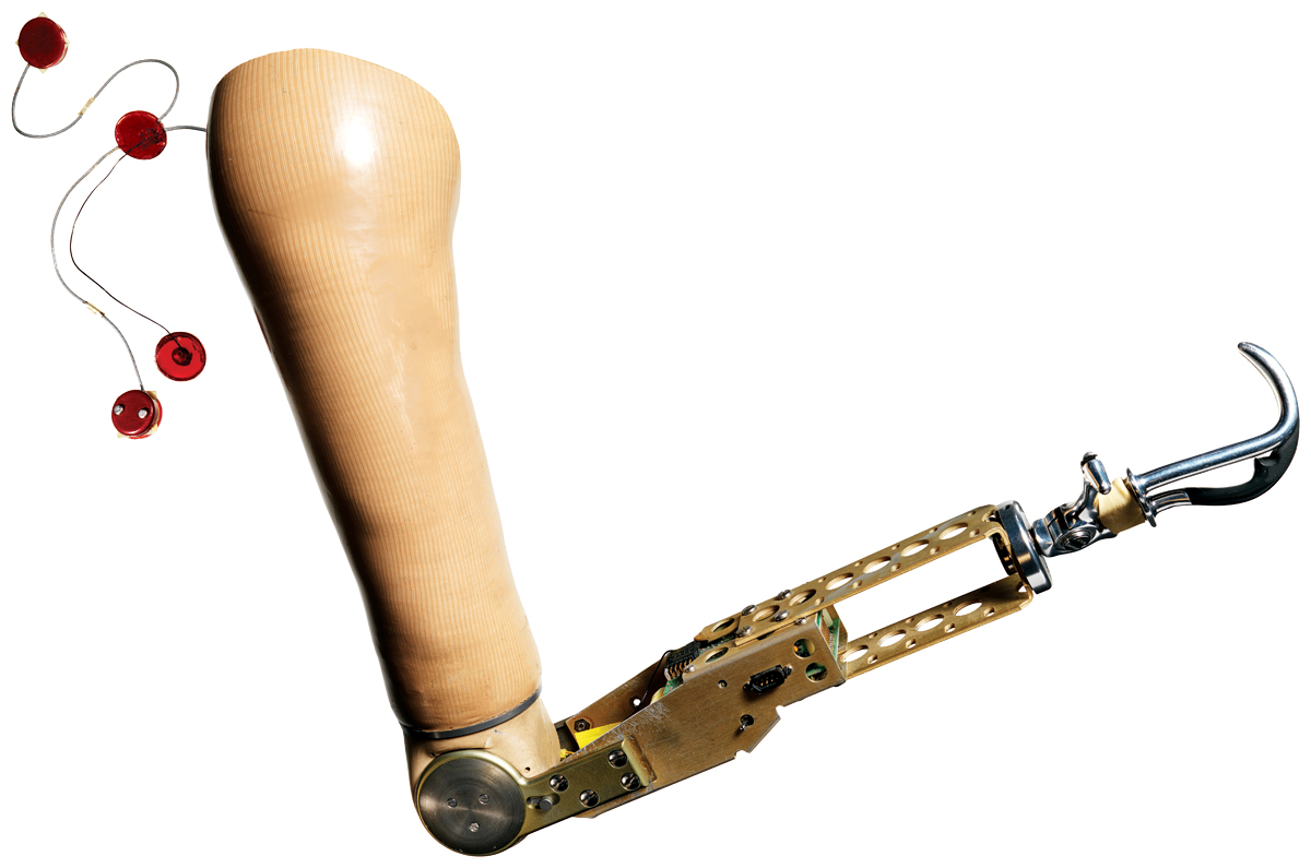 limb prothesis Johnny matheny is the first person to attach a mind-controlled prosthetic limb directly to his skeleton after losing his arm to cancer in 2008, johnny signe. limb prothesis Johnny matheny is the first person to attach a mind-controlled prosthetic limb directly to his skeleton after losing his arm to cancer in 2008, johnny signe.