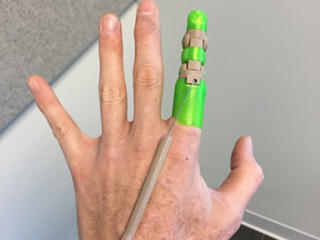 Protesis de dedo
