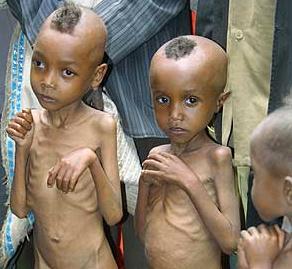 children-starving-ethiopia.jpg