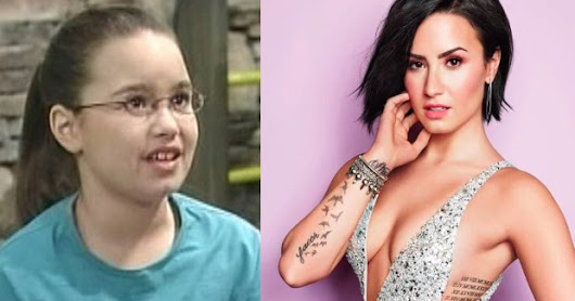 25 Awkward Childhood Stars Who Turned Insanely Hot