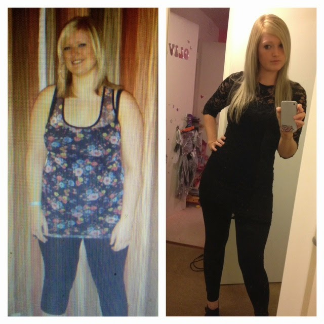 Before And After Weight Loss Duromine Before And After Weight Loss