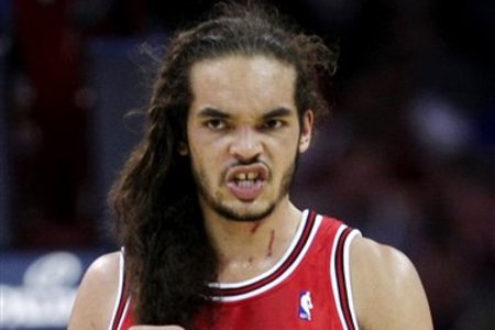 Chris Bosh Ugly