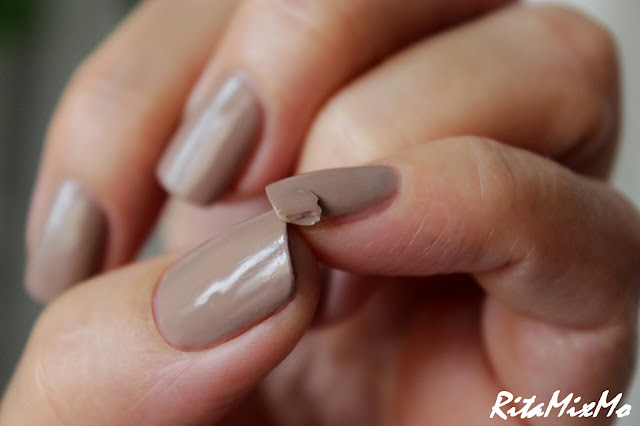 Почему становятся тонкими ногти на руках.