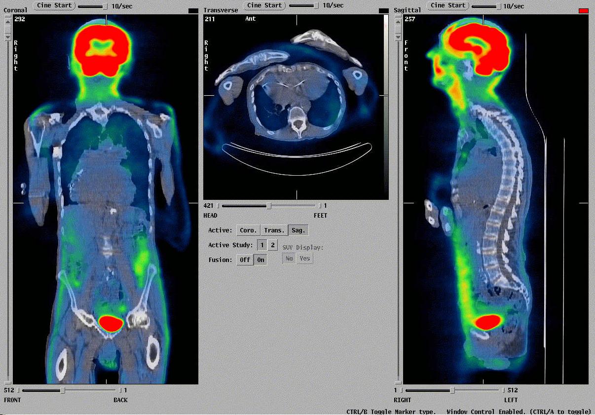 The 'What Would Batman Do?' Project PET Scan