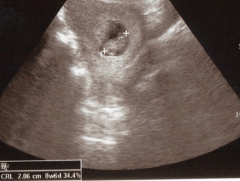 Il Diario Della Mia Gravidanza 9 Settimane Di Gravidanza