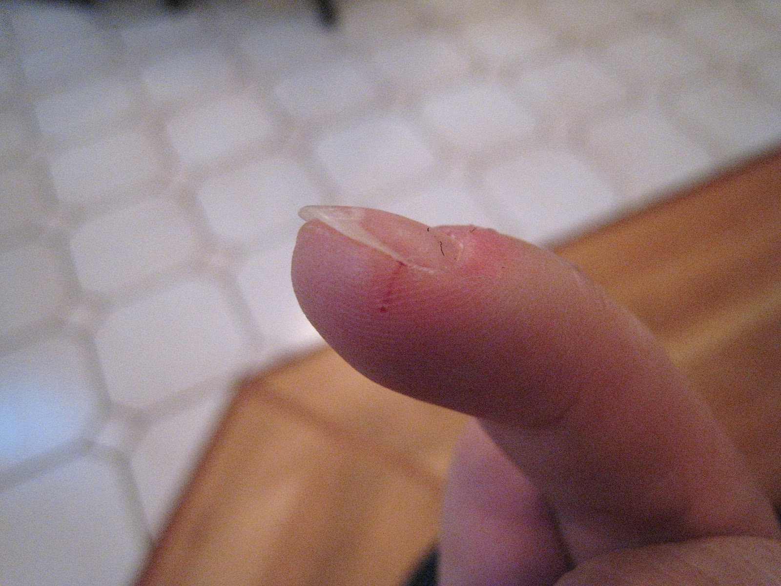 stabbed-finger-with-sewing-needle