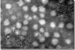 Flavivirus nhìn dưới kính hiển vi điện tử.