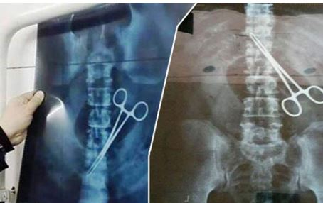 Shocker: Saudi authorities find scissors in belly of Nigerian pilgrim Shocker: Saudi authorities find scissors in belly of Nigerian pilgrim