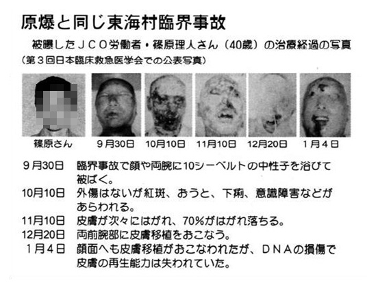 Image result for 도카이 방사능 누출 사고