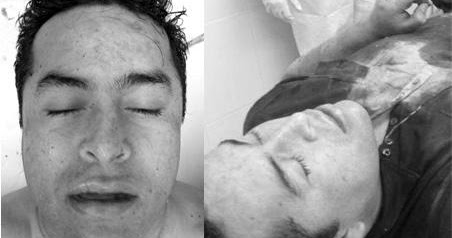 death crime scene lazca