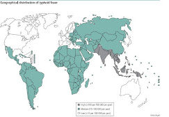 Typhoid Fever Outbreaks