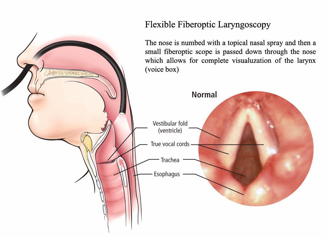 Alexandria endoscopic mouth tour uvula tonsils