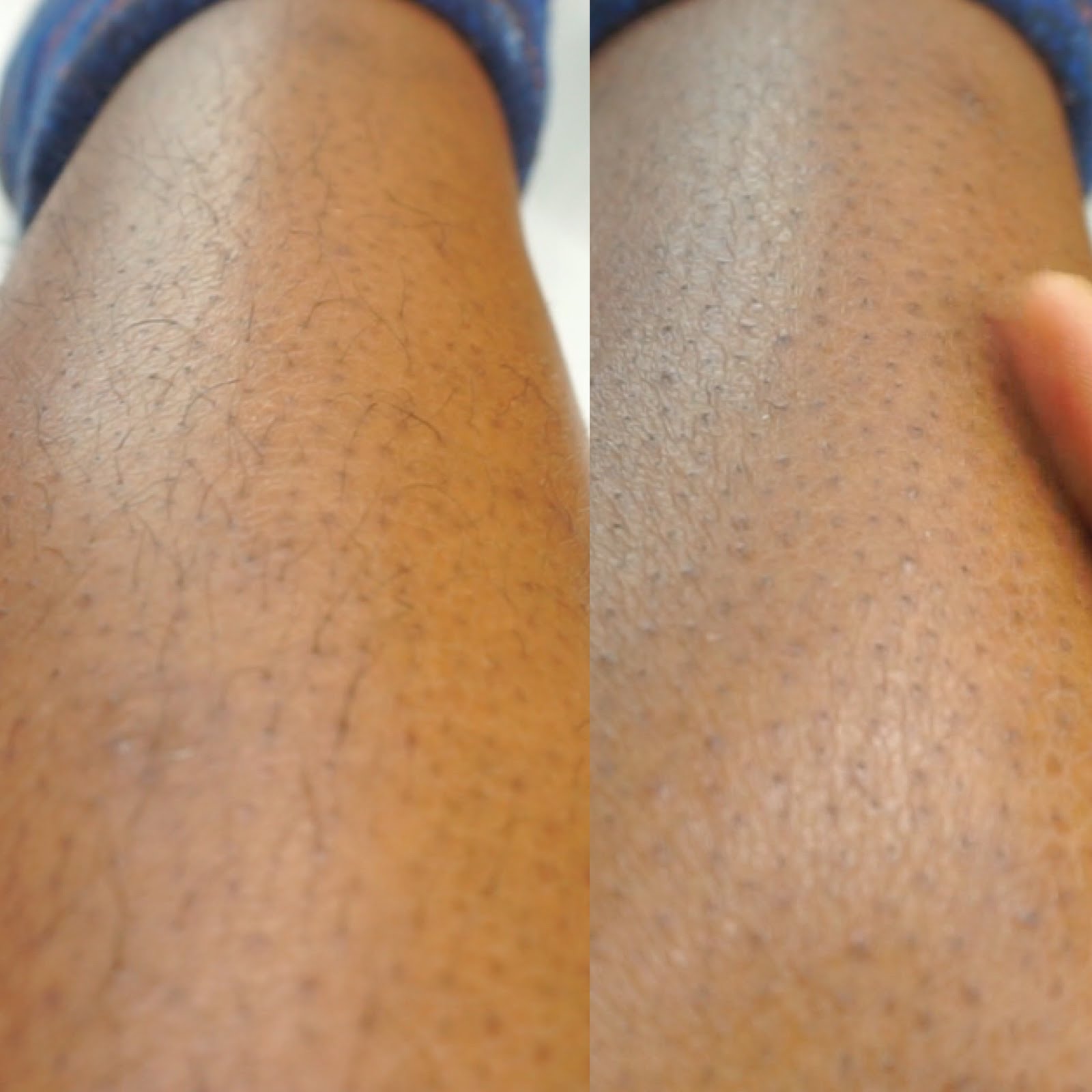 Finishing Touch Yes Review Pain Free Hair Remover Skin First