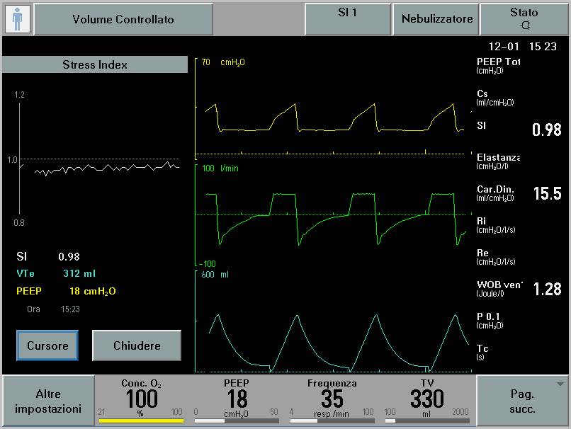 FREMITUS The Minimal SSI Strategy
