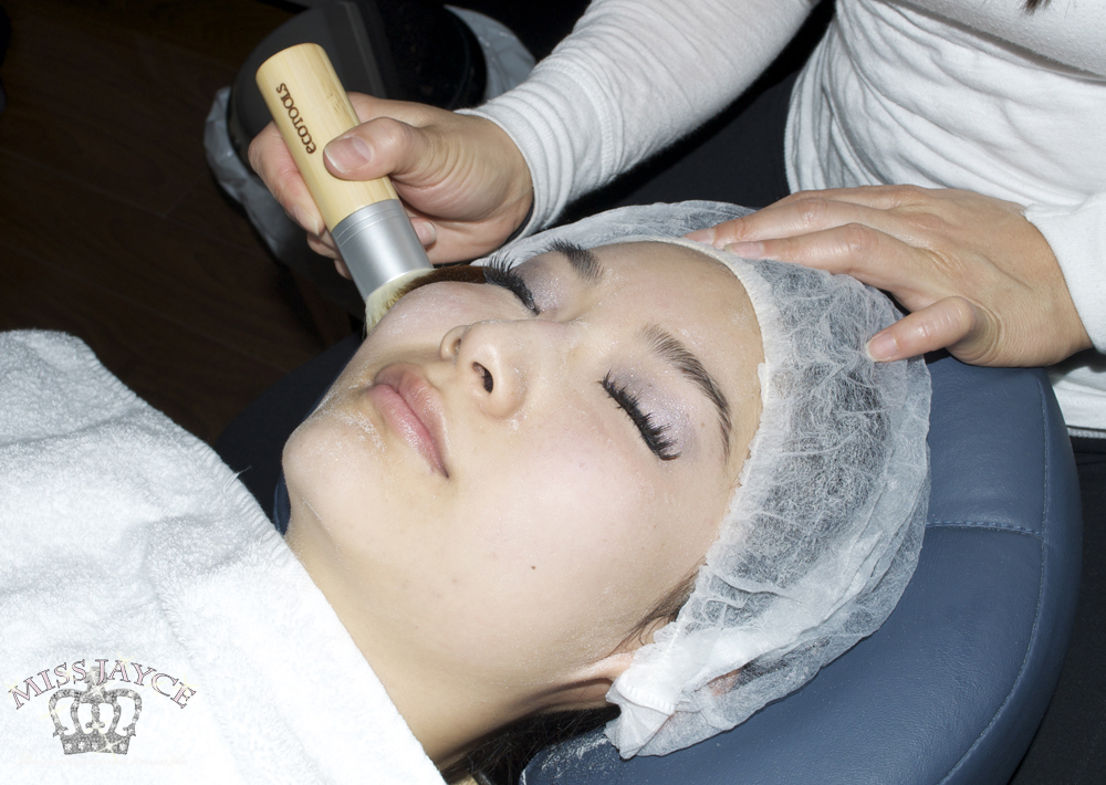 Bad+microdermabrasion