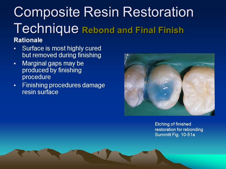 Dentistry Composite Resin