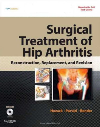 Surgical Treatment of Hip Arthritis: Reconstruction, Replacement, and Revision Expert Consult - Online and Print