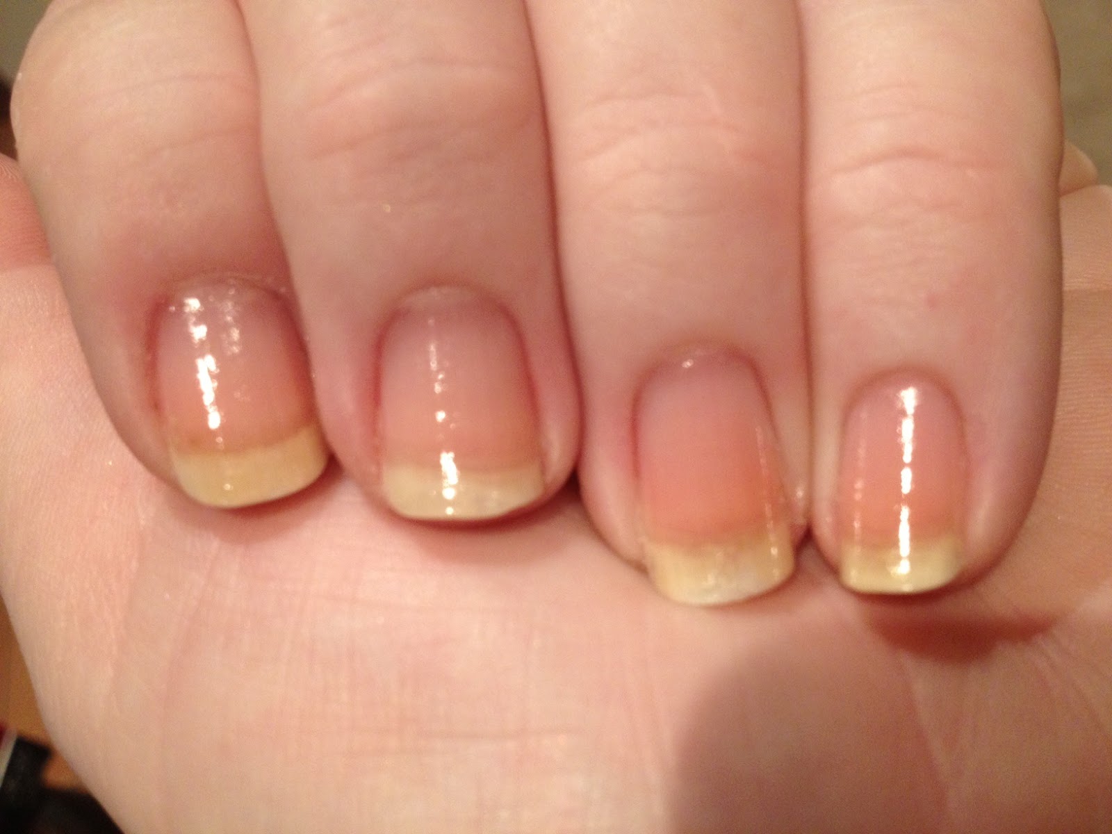 Hissycat Krissy From Bitten to Smitten 10 Tips to Help You Quit Nail