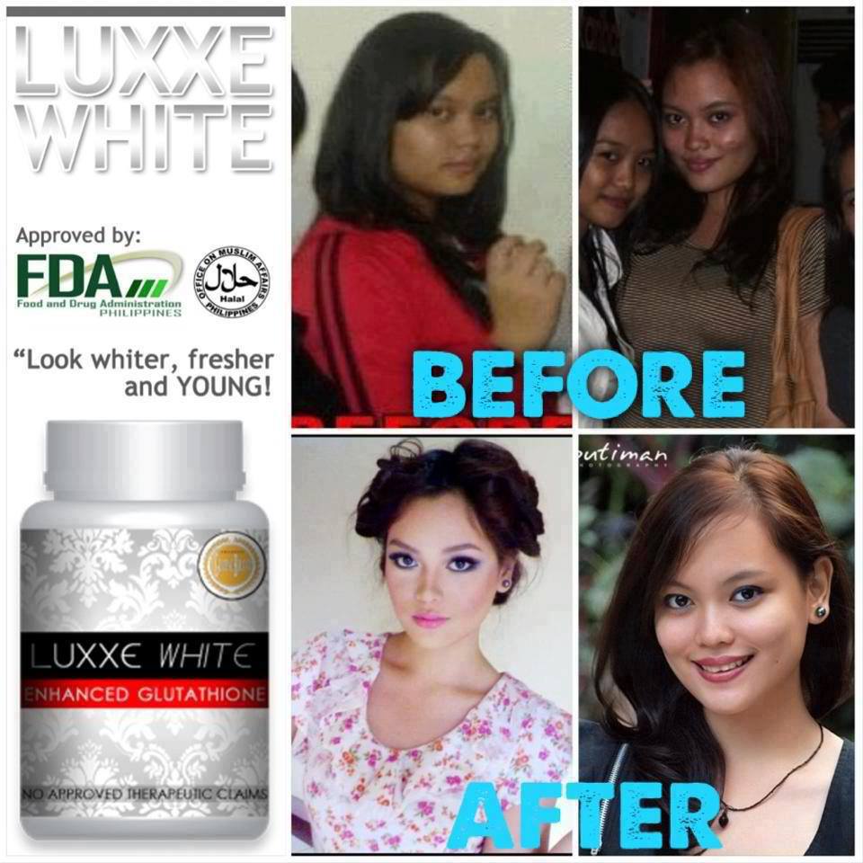 SEARCH AND BUY THIS PRODUCT LUXXE PRODUCT: LUXXE WHITE ENHANCE GLUTATHIONE