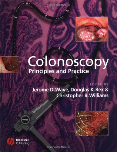Colonoscopy: Principles and Practice 