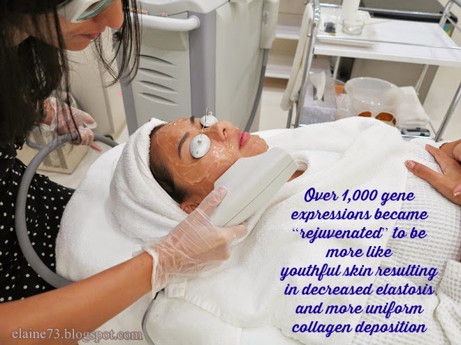 bbl hydrafacial sciton