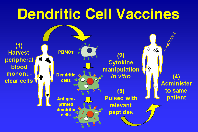 Image result for dendritic cell vaccine