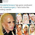 World-renown fashionista Donatella Versace goes through treatments and surgery making her look like a wax candle! Photos of her transformation here!