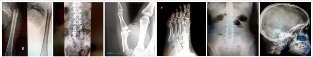 DICAS DE RADIOLOGIA - Tudo Sobre Radiologia