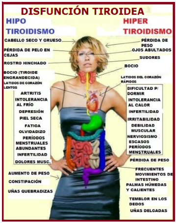 Mañana "Dia Mundial de la Tiroides " Mx3A377