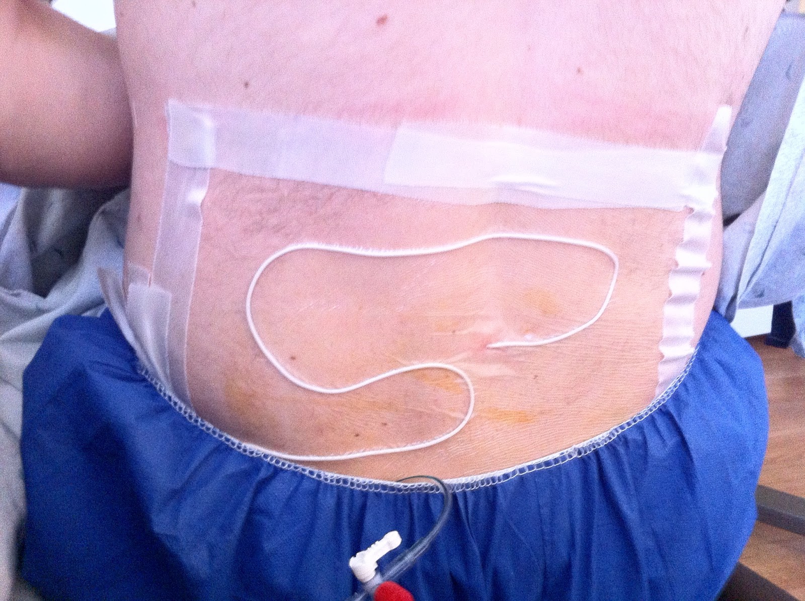 Scott & Carrie's Musings Thursday Night NearDeath