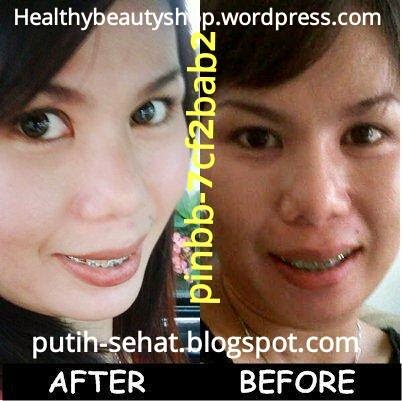 pemutih kulit wajah alami 171 skin care cosmetic herbal pemutih kulit wajah alami 171 skin care cosmetic herbal